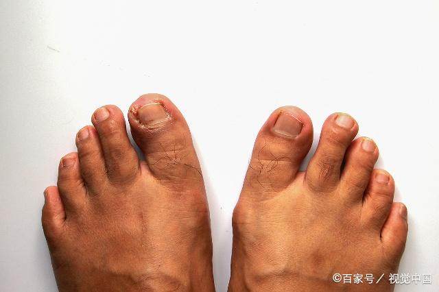 AG亚娱集团官方